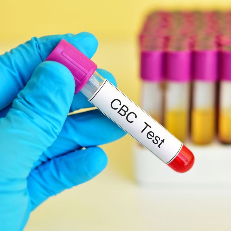 Complete Blood Count Test (CBC)