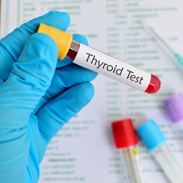 Thyroid Function Test